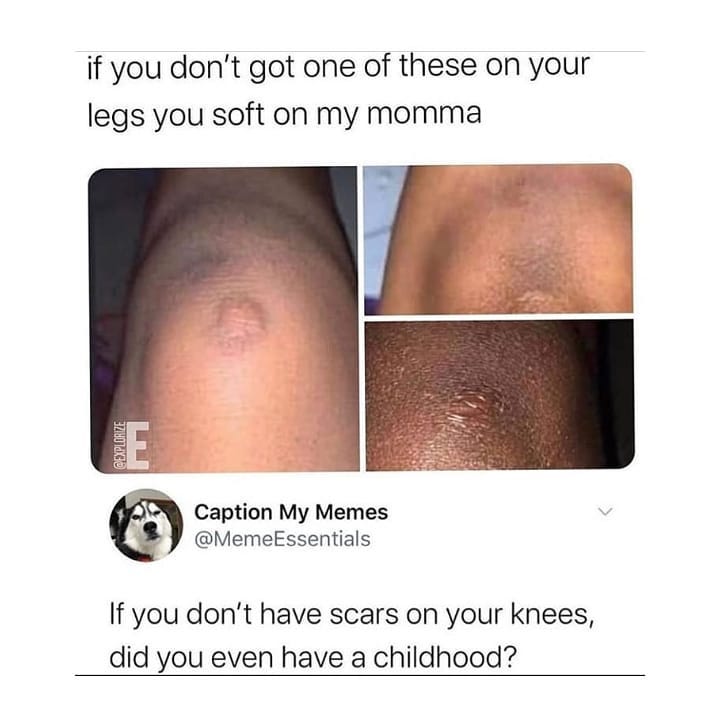 dank memes - neck - if you don't got one of these on your legs you soft on my momma E Caption My Memes Essentials If you don't have scars on your knees, did you even have a childhood?