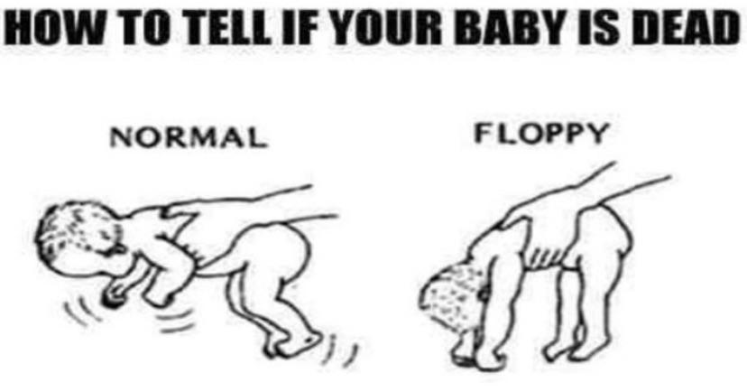 How To Tell If Your Baby Is Dead Normal Floppy