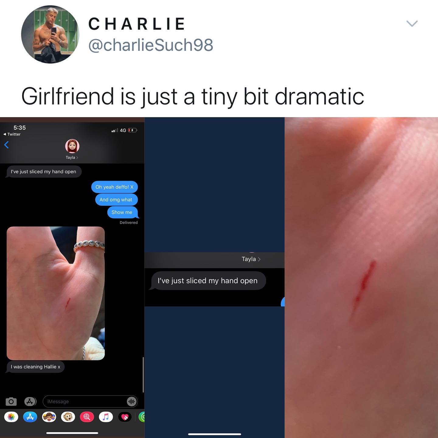 dank memes - twitter - lip - V Charlie Such98 Girlfriend is just a tiny bit dramatic Twitter . 46 Tayla I've just sliced my hand open Oh yeah deffo! X And omg what Show me Delivered Tayla > I've just sliced my hand open I was cleaning Hallie x 4 iMessage 