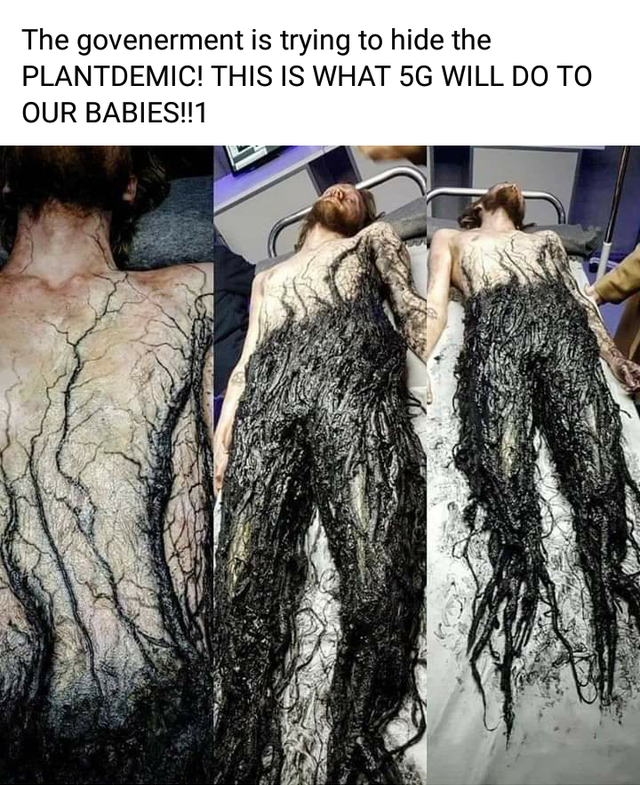 The govenerment is trying to hide the Plantdemic! This Is What 5G Will Do To Our Babies!!1