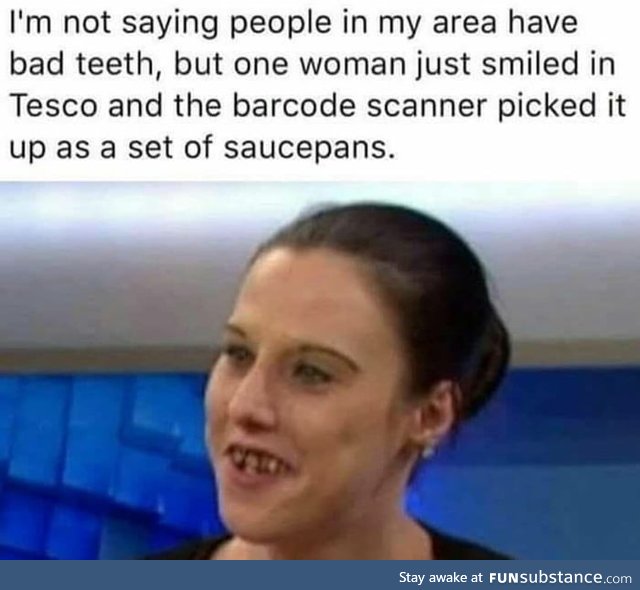 I'm not saying people in my area have bad teeth, but one woman just smiled in tesco and the barcode scanner picked it up as a set of saucepans.