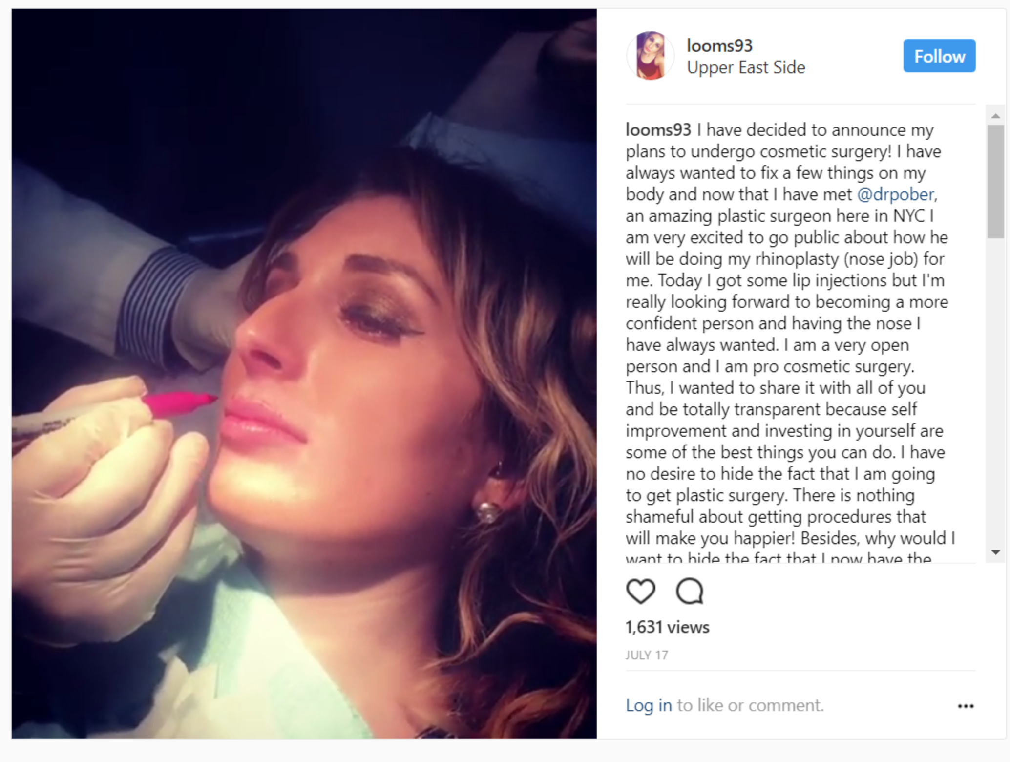 laura loomer nose - looms93 Upper East Side looms93 I have decided to announce my plans to undergo cosmetic surgery! I have always wanted to fix a few things on my body and now that I have met , an amazing plastic surgeon here in Nyc am very excited to go