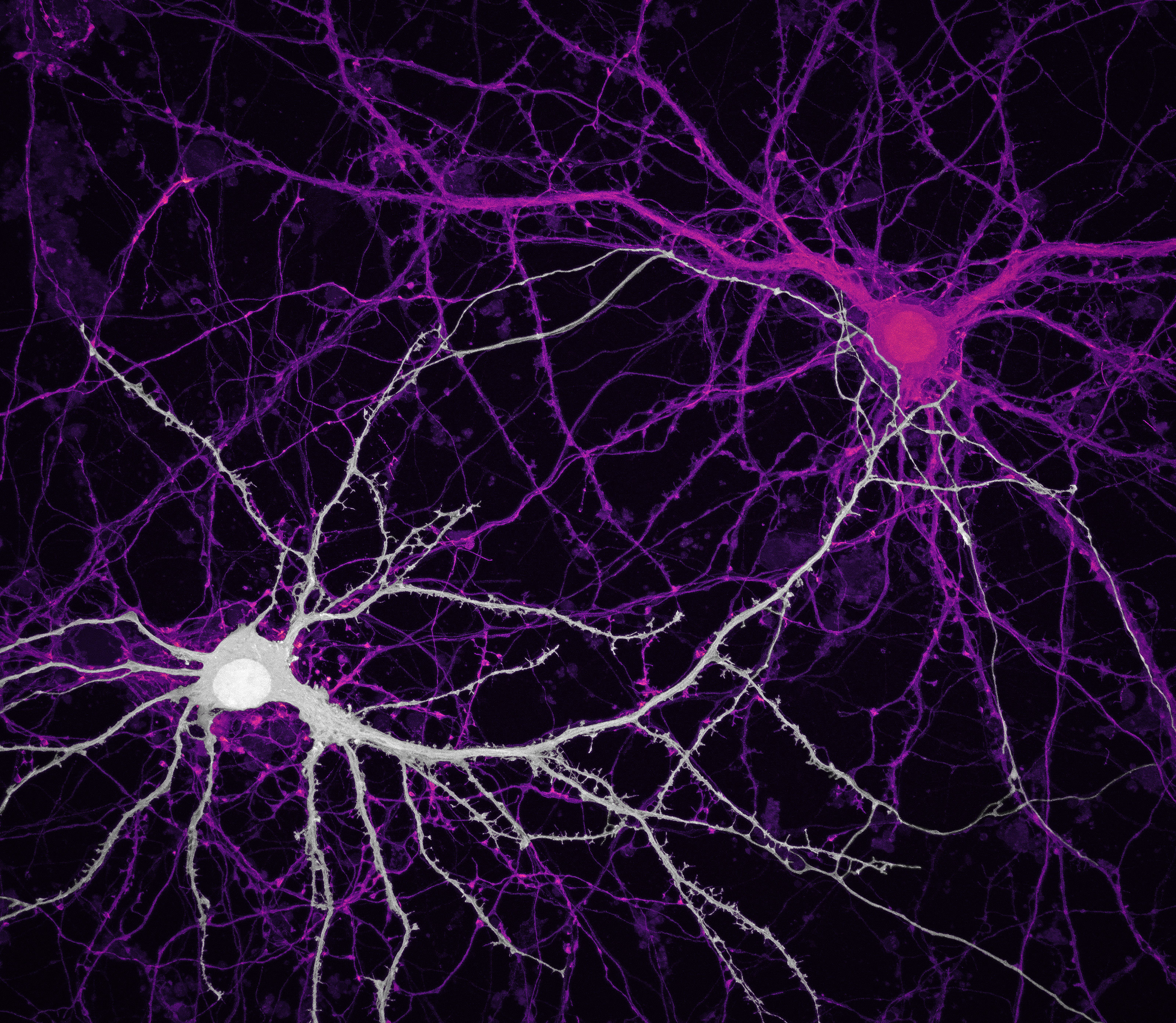 2020 nikon photomicrography competition winners - Connections between hippocampal neurons (brain cells)