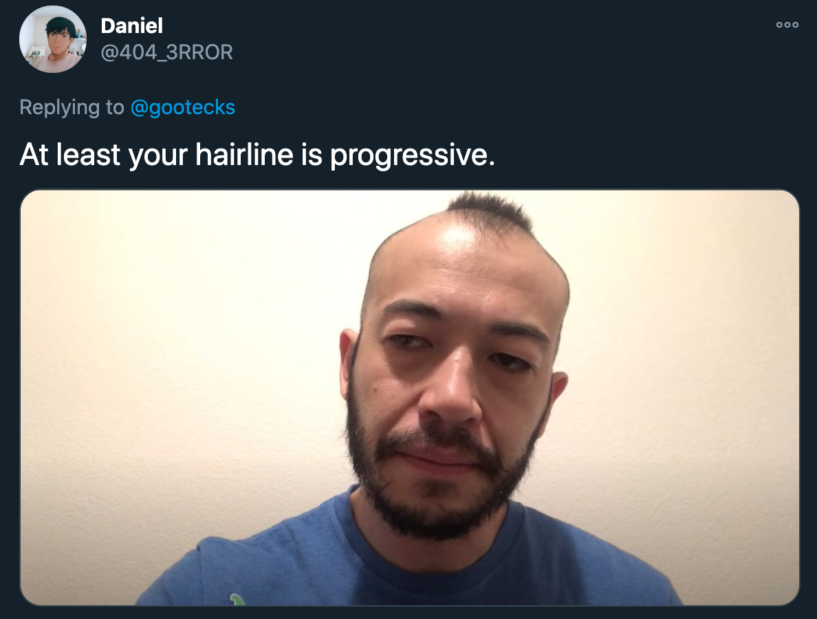 At least your hairline is progressive.