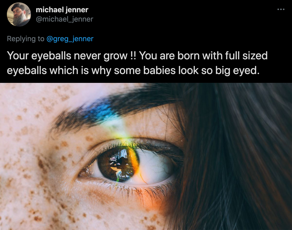 cool facts - Your eyeballs never grow !! You are born with full sized eyeballs which is why some babies look so big eyed.
