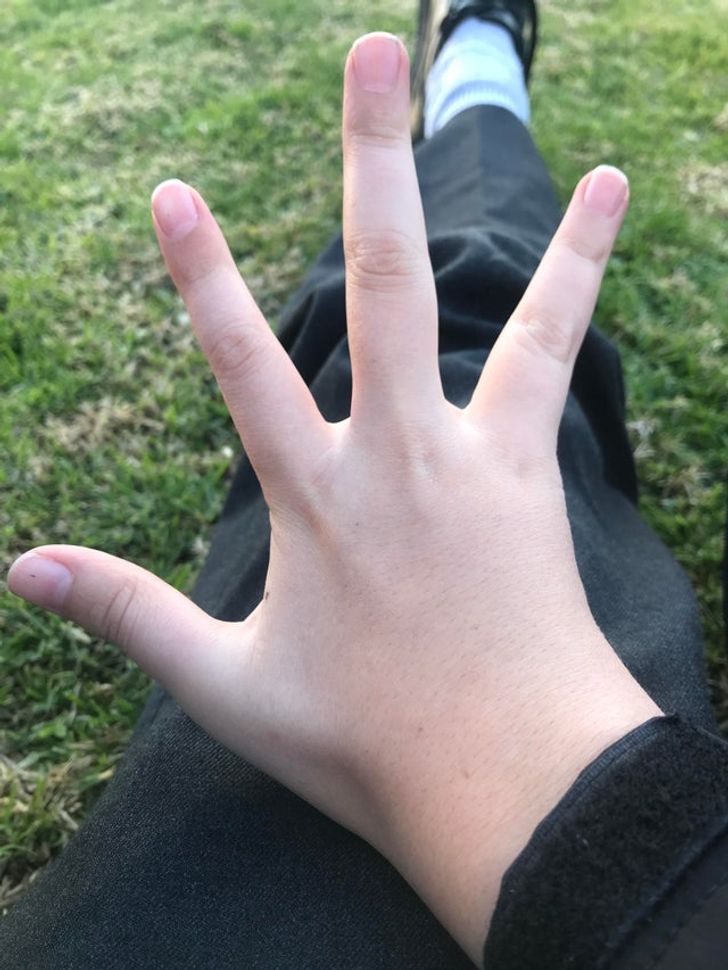 fascinating photos - four fingers reddit