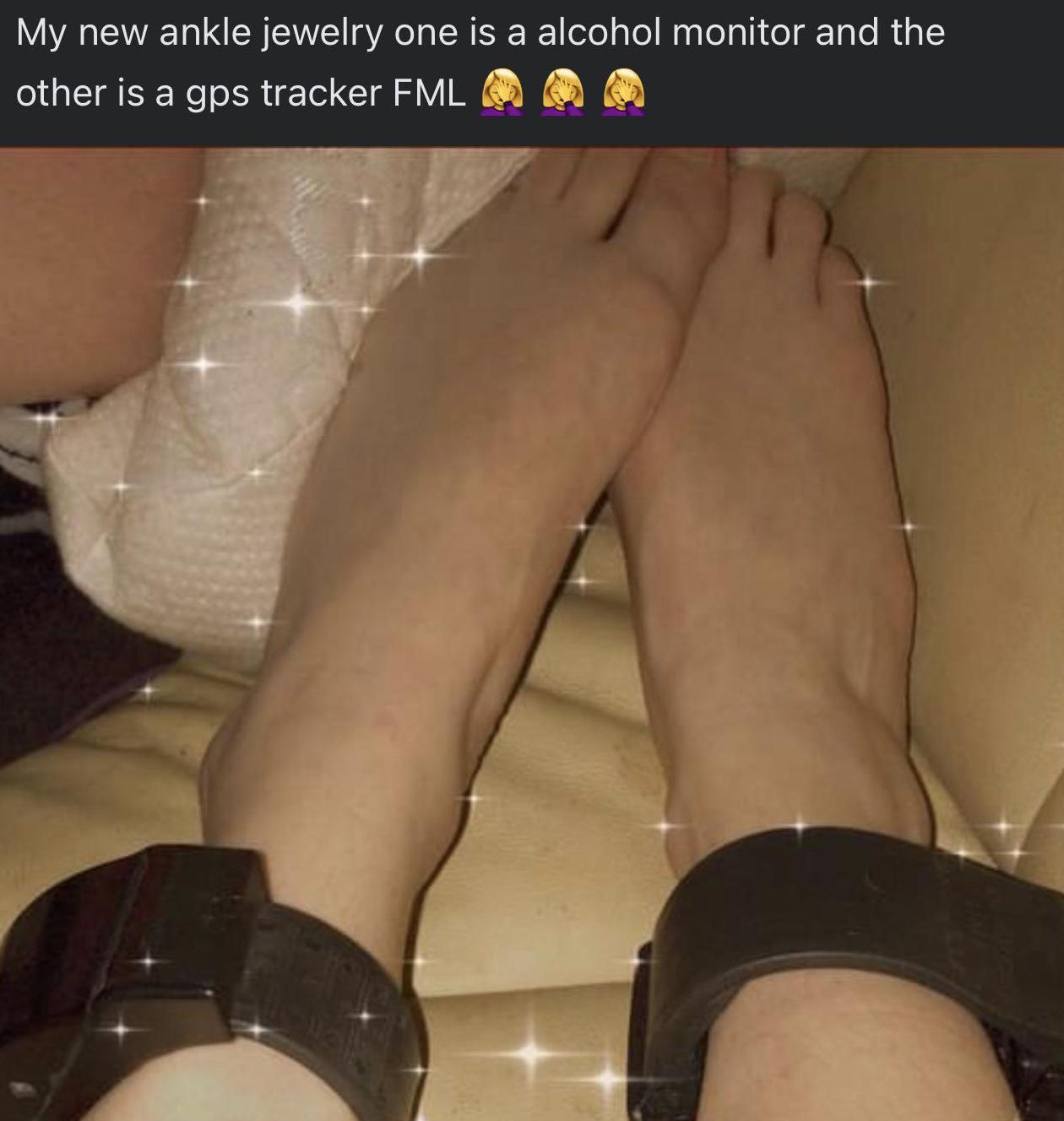 trashy photos - human leg - My new ankle jewelry one is a alcohol monitor and the other is a gps tracker Fml