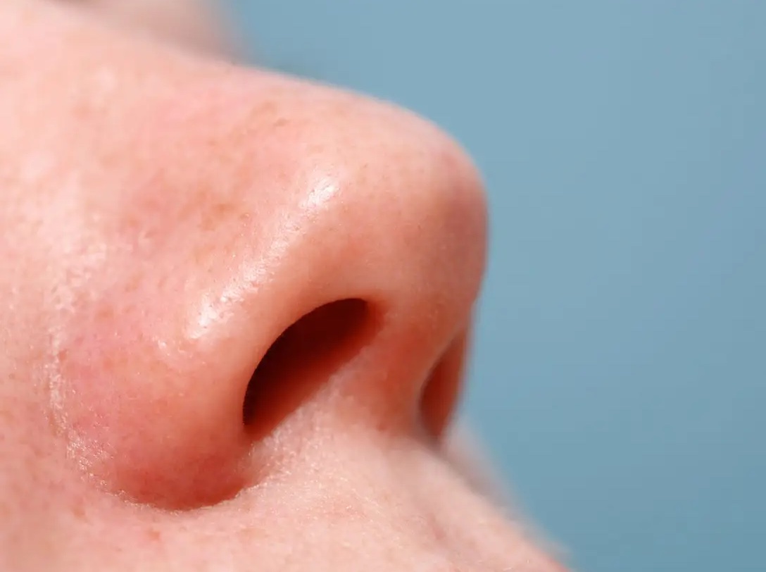 Minor Injuries That Actually Hurt - bacteria infection of nose