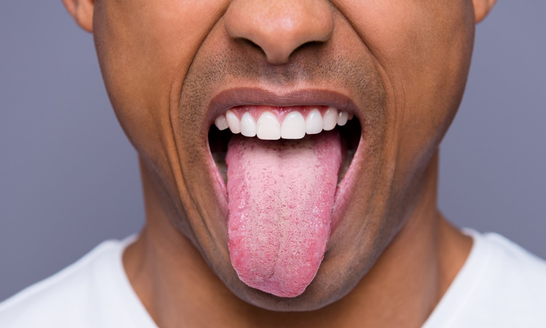 Minor Injuries That Actually Hurt - healthy tongue - Han