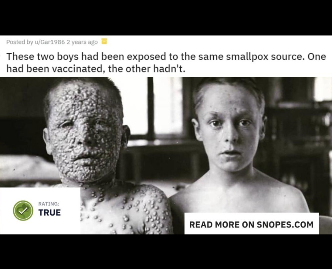 Snopes Facts - Smallpox - Posted by uGar1986 2 years ago These two boys had been exposed to the same smallpox source. One had been vaccinated, the other hadn't. Rating True Read More On Snopes.Com