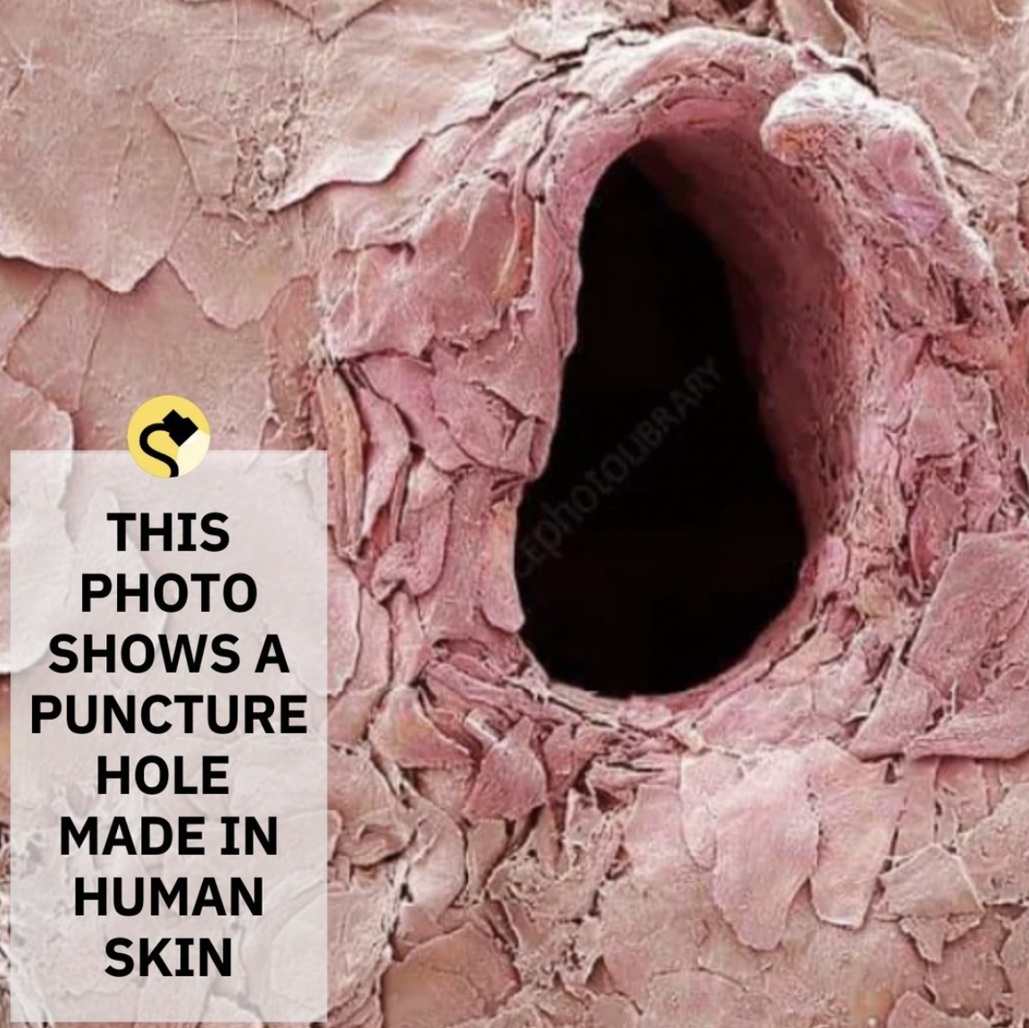Snopes Facts - needle puncture - photoLIBRARY This Photo Shows A Puncture Hole Made In Human Skin