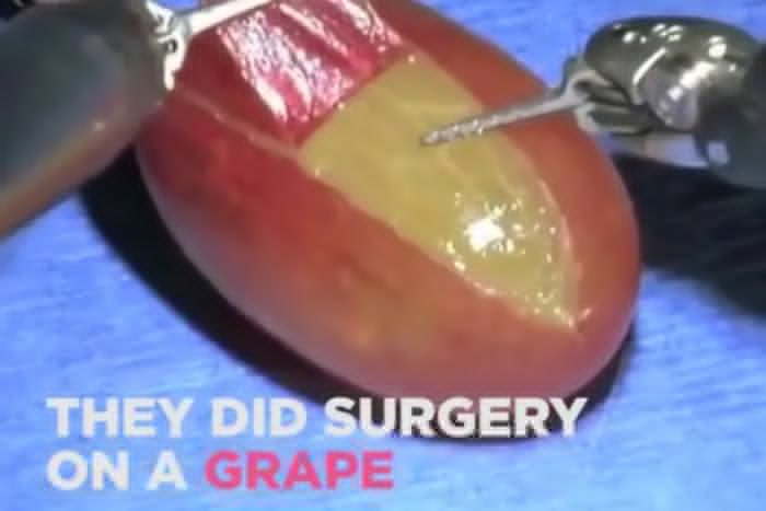 historic internet moments - grape surgery gif - They Did Surgery On A Grape