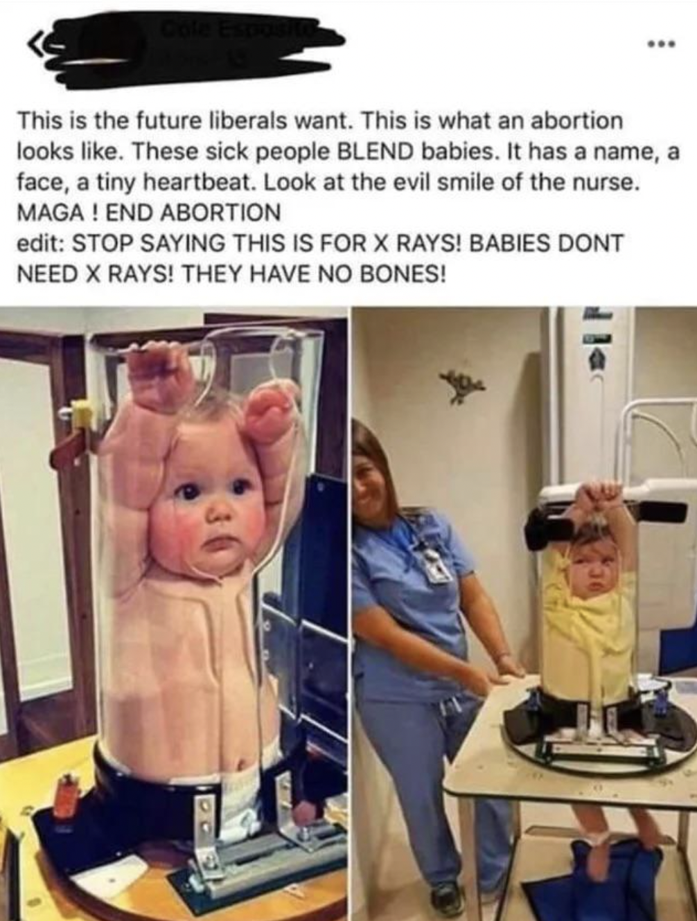 Foolish Facepalms - baby blender meme - This is the future liberals want. This is what an abortion looks . These sick people Blend babies. It has a name, a face, a tiny heartbeat. Look at the evil smile of the nurse. Maga! End Abortion edit Stop Saying Th