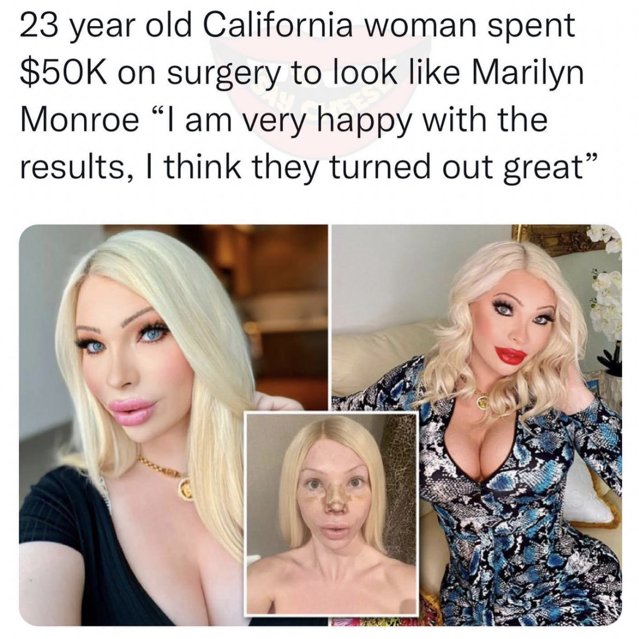 Facepalms and fails - blond - 23 year old California woman spent $50K on surgery to look Marilyn Monroe