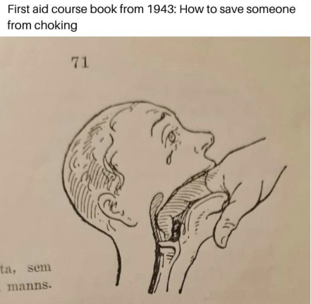 Fascinating Photos - first aid course book from 1943 - First aid course book from 1943 How to save someone from choking ta, sem manns. 71