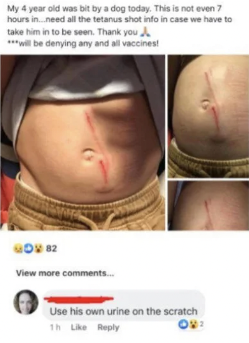 facepalms and fails - abdomen - My 4 year old was bit by a dog today. This is not even 7 hours in...need all the tetanus shot info in case we have to take him in to be seen. Thank you will be denying any and all vaccines! Mov 82 View more ... Use his own