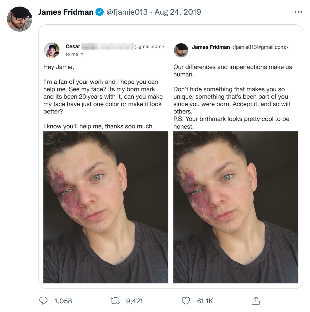 wholesome photoshop edits - james fridman birthmark - James Fridman Cesar to me. O Hey Jamie, I'm a fan of your work and I hope you can help me. See my face? Its my born mark and its been 20 years with it, can you make my face have just one color or make 