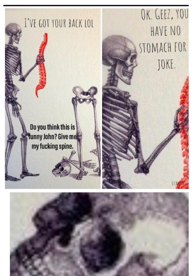 halloween memes - skeletons favorite snack - I'Ve Got Your Back Lol Do you think this is funny John? Give me my fucking spine. Ok. Geez, You Have No Stomach For Joke. UAlost
