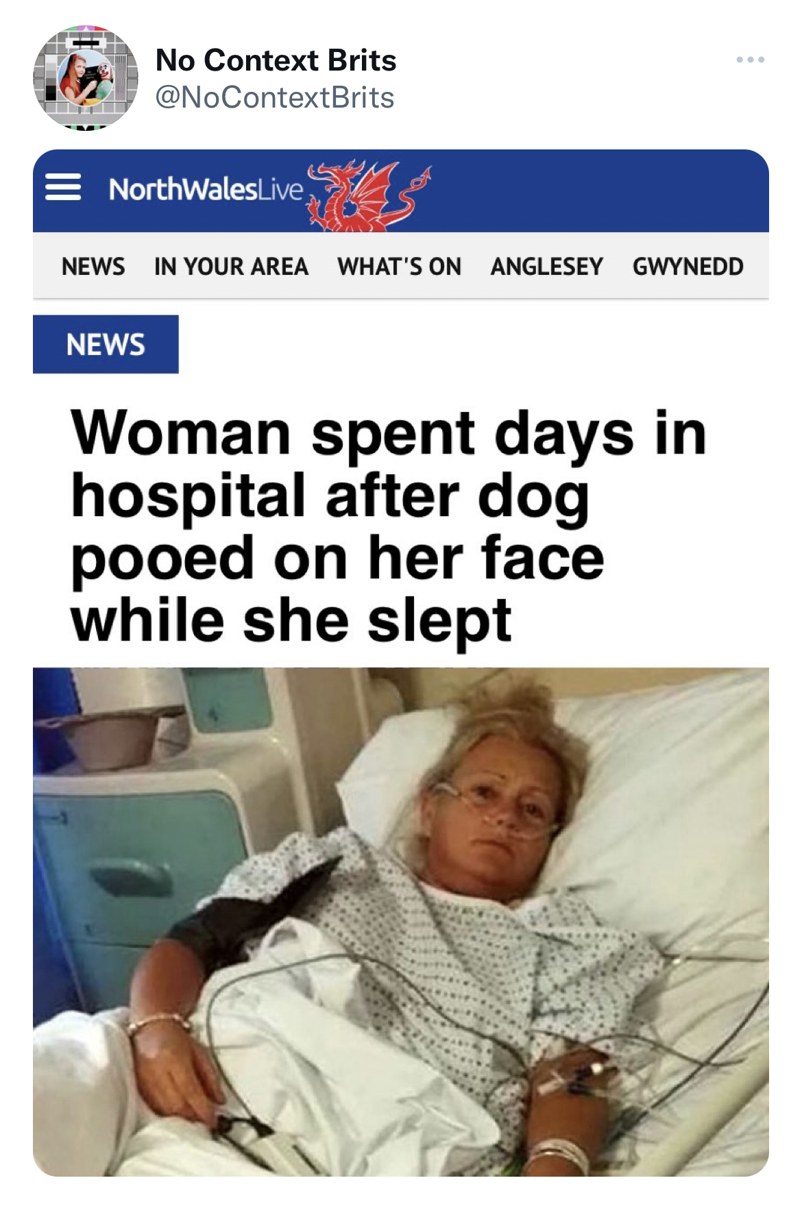 Funny tweets - media - No Context Brits NorthWales Live News In Your Area What'S On Anglesey Gwynedd News Woman spent days in hospital after dog pooed on her face while she slept