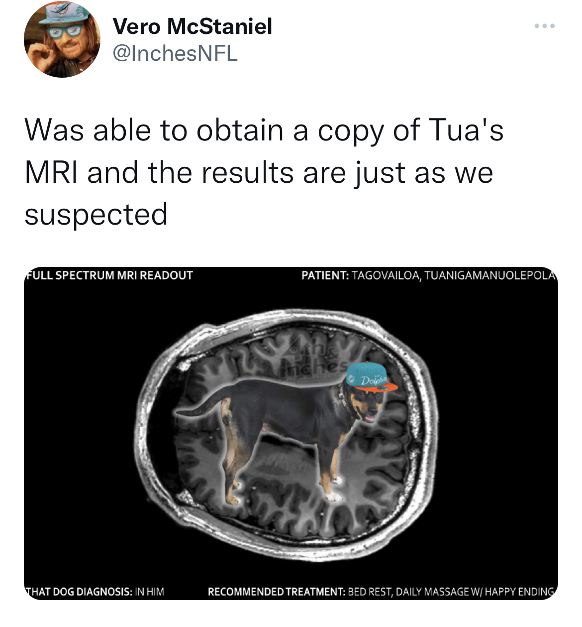 nfl memes - brain - Vero McStaniel Was able to obtain a copy of Tua's Mri and the results are just as we suspected Full Spectrum Mri Readout That Dog Diagnosis In Him Patient Tagovailoa, Tuanigamanuolepola Th Recommended Treatment Bed Rest, Daily Massage 