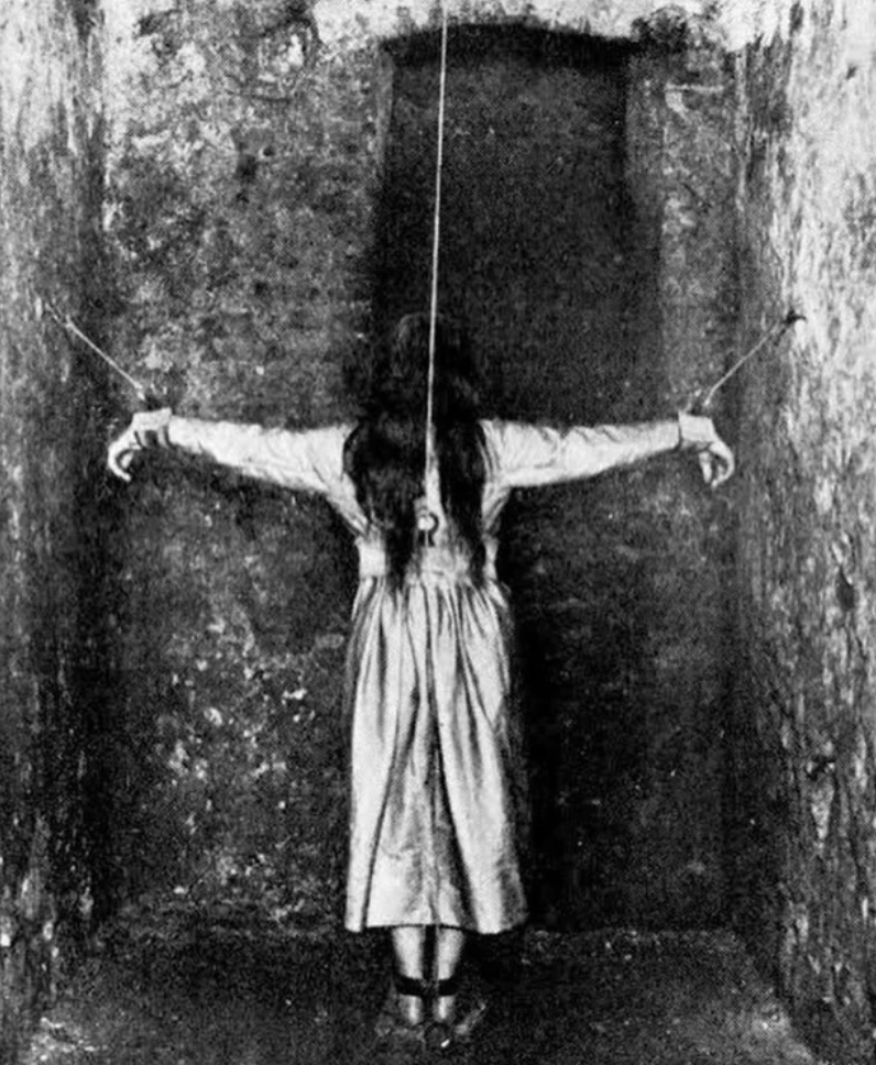 horrifying historical photos - patient undergoing treatment for mental illness