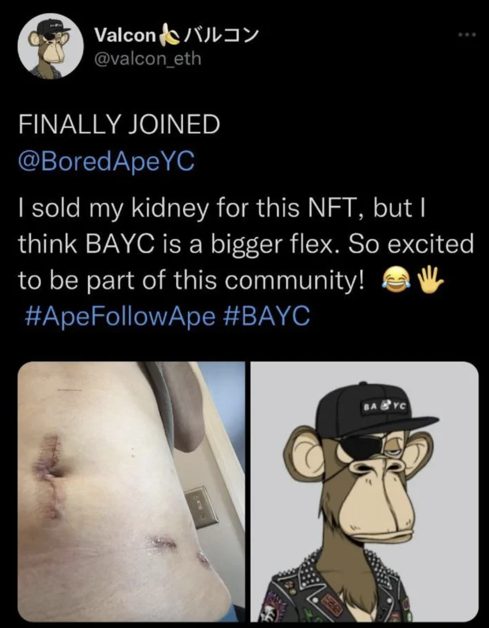 cartoon - Valcon Finally Joined I sold my kidney for this Nft, but I think Bayc is a bigger flex. So excited to be part of this community! Bayc