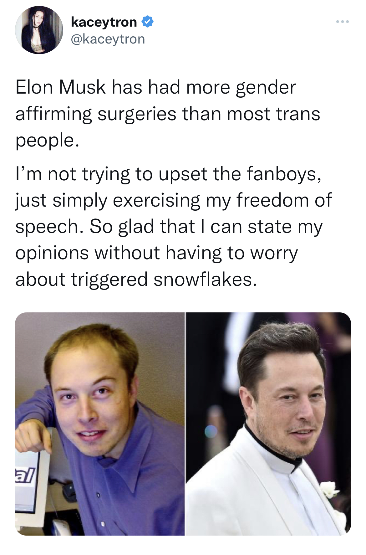 Celebs get roasted on twitter - media - 8 Elon Musk has had more gender affirming surgeries than most trans people. kaceytron I'm not trying to upset the fanboys, just simply exercising my freedom of speech. So glad that I can state my opinions without ha