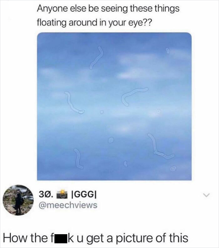 eye floaters reddit - Anyone else be seeing these things floating around in your eye?? 30. |Ggg| How the fk u get a picture of this