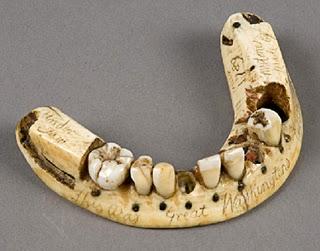 creepy and captivating photos - history of denture - His 119 mitme Kimy