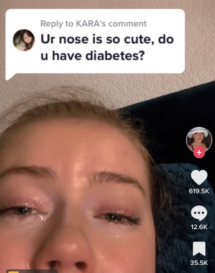 Unhinged TikTok Screenshots - lip - to Kara's comment Ur nose is so cute, do u have diabetes?