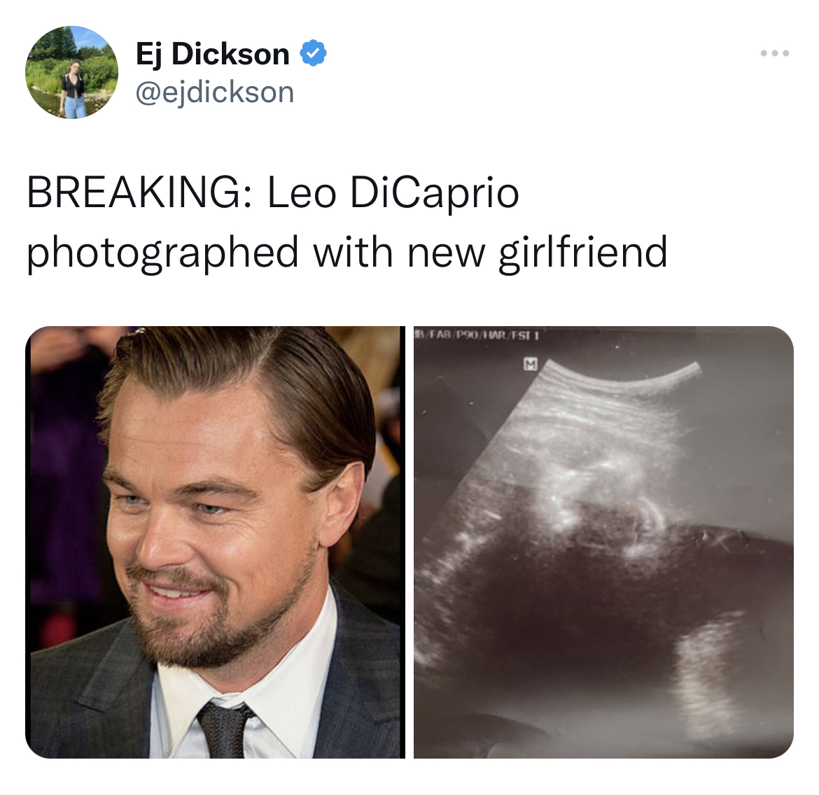 Leonardo DiCaprio Girlfriend Memes - leonardo dicaprio - Ej Dickson Breaking Leo DiCaprio photographed with new girlfriend Tag Har F