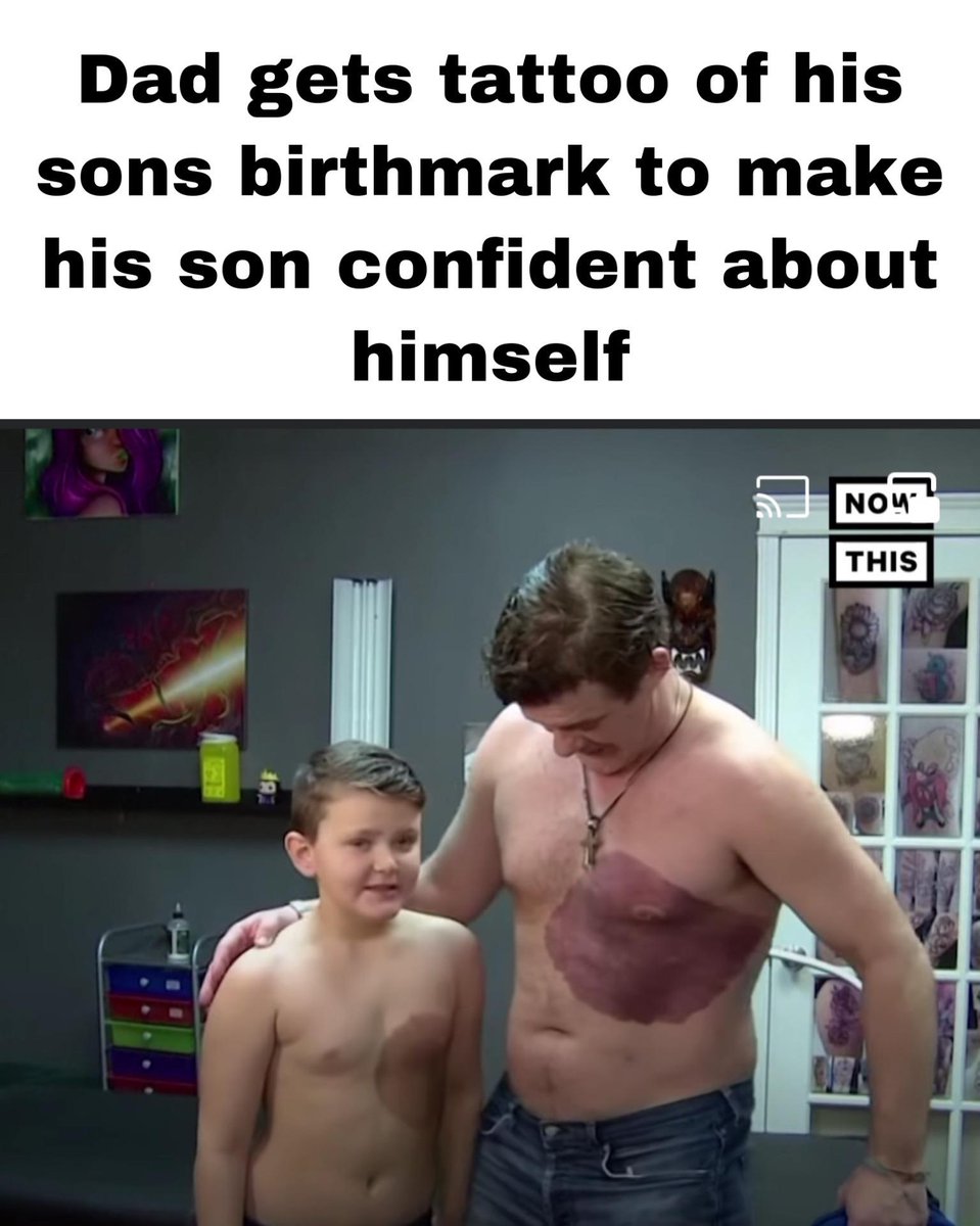 Bros helping bros - barechestedness - Dad gets tattoo of his sons birthmark to make his son confident about himself Nom This