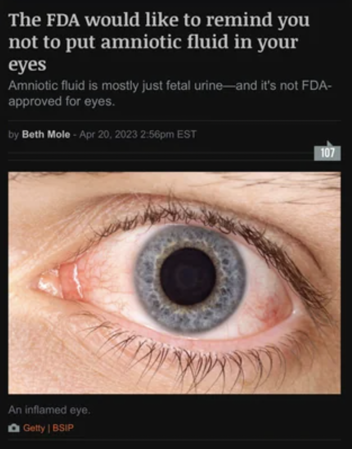 not normal eye - The Fda would to remind you not to put amniotic fluid in your eyes Amniotic fluid is mostly just fetal urine and it's not Fda approved for eyes. by Beth Mole pm Est An inflamed eye. Getty | Bsip 107