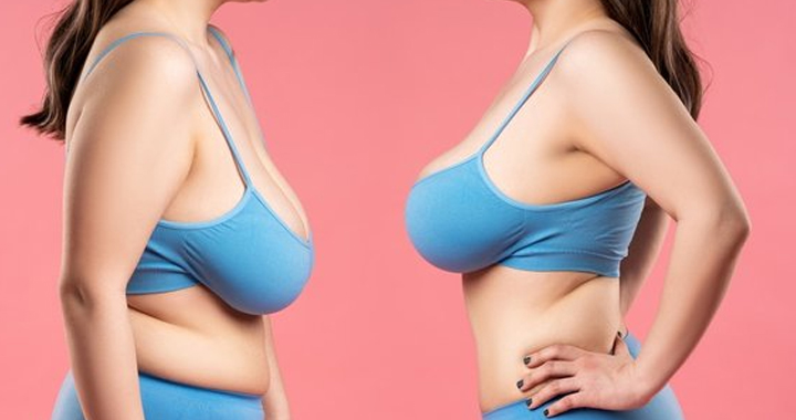 thing women dislike about their bodies but men love -  dd breast lift