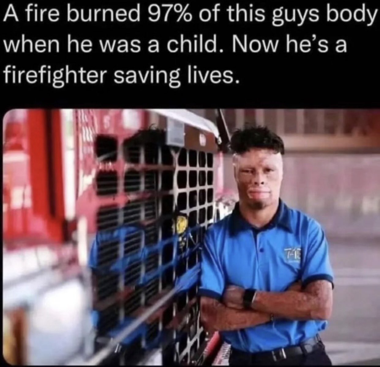 dudes posting their Ws - muscle - A fire burned 97% of this guys body when he was a child. Now he's a firefighter saving lives. The