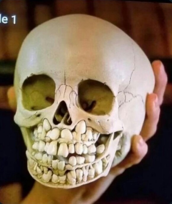 A child's skull, showing teeth inside the mandible, ready to replace their baby teeth.