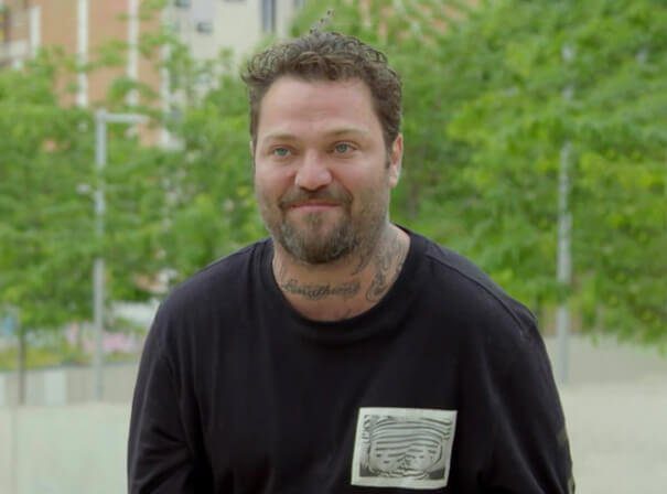 Bam Margera for me. He looks horrible now, like his dad but worse. Wouldn't be surprised if I wake up one morning and he's dead. u/True_Egg_5685