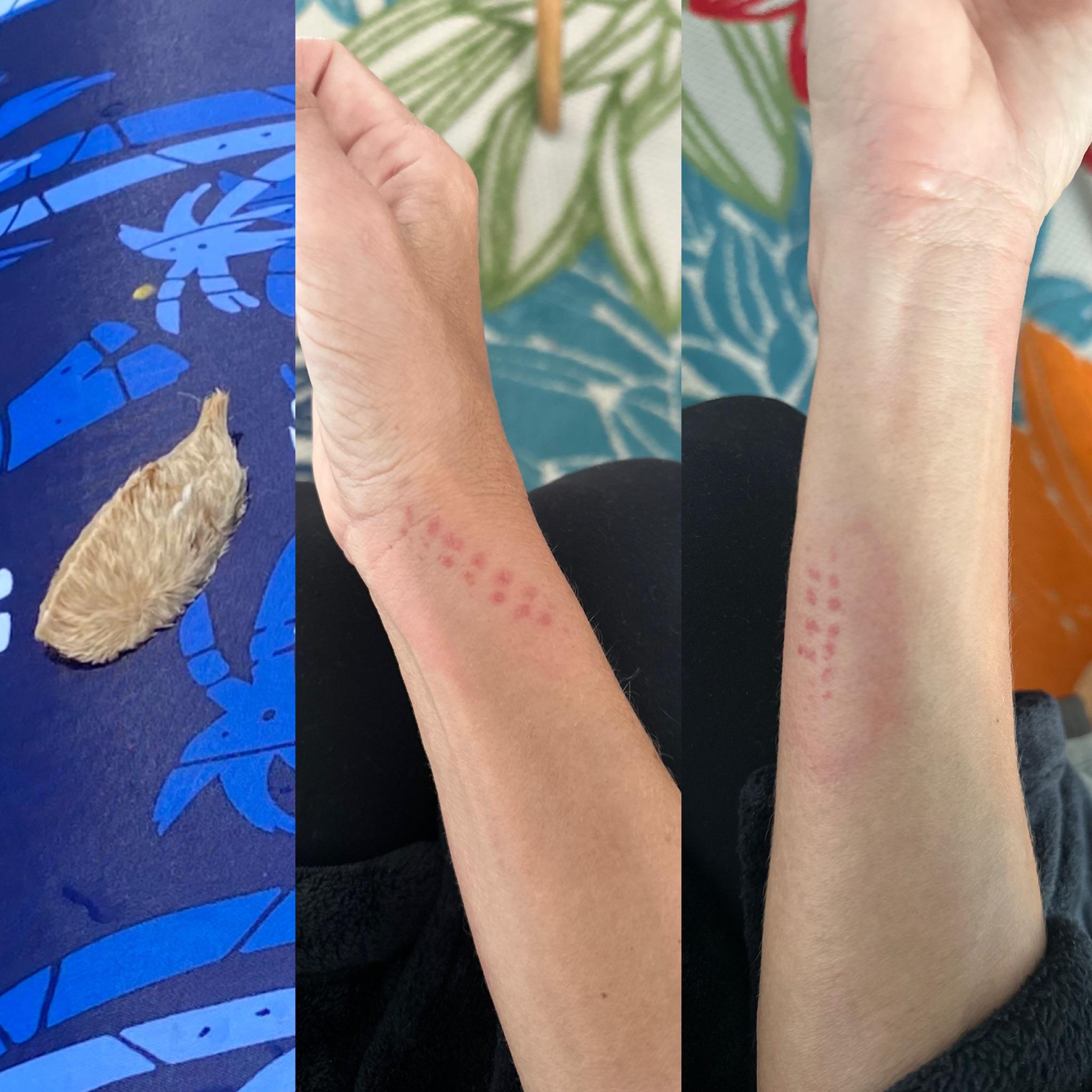 Puss Caterpillar marks