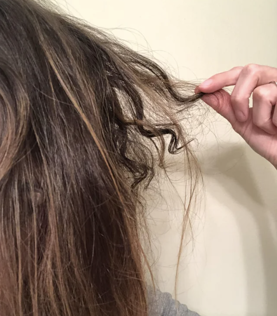 A patch of my hair fell out 1.5 years ago and has grown back curly.