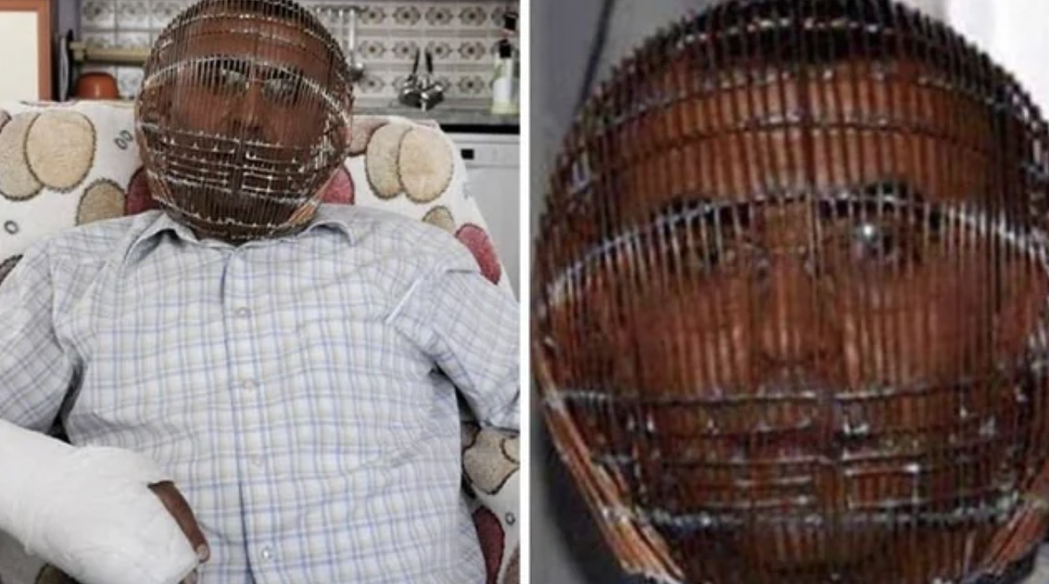 “In 2013, a man locked his head in a cage to try quit smoking. Ibrahim Yücel from Turkey took this drastic measure after other methods failed.”