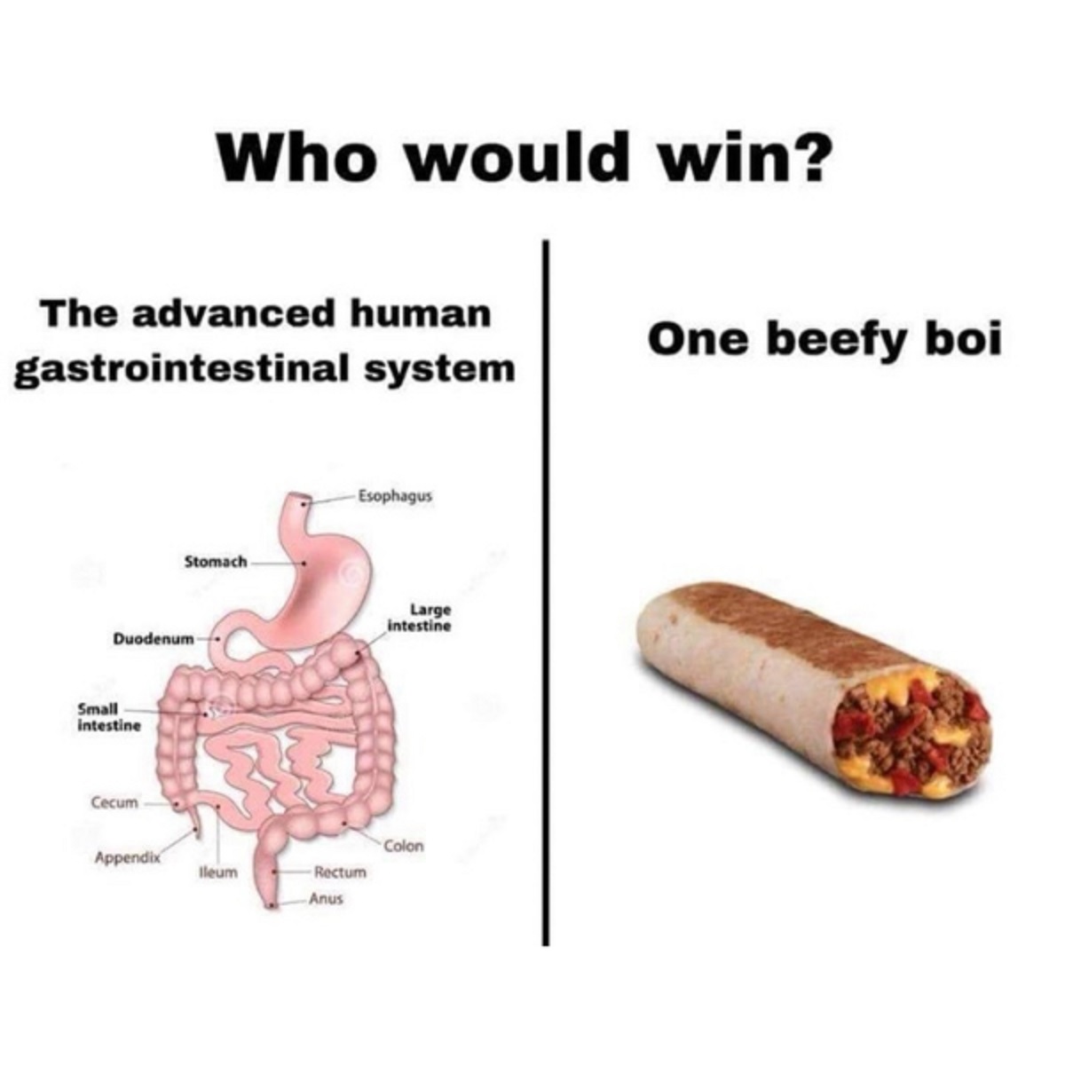 beefy boi - The advanced human gastrointestinal system Duodenum Small intestine Cecum Who would win? Appendix Stomach lleum Esophagus Rectum Anus Large intestine Colon One beefy boi