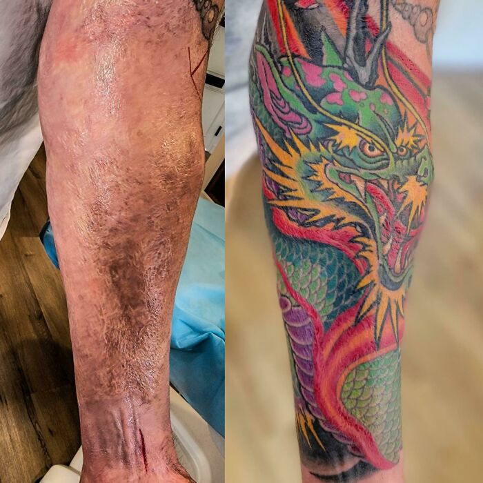 awesome tattoos - tattoo on burned skin
