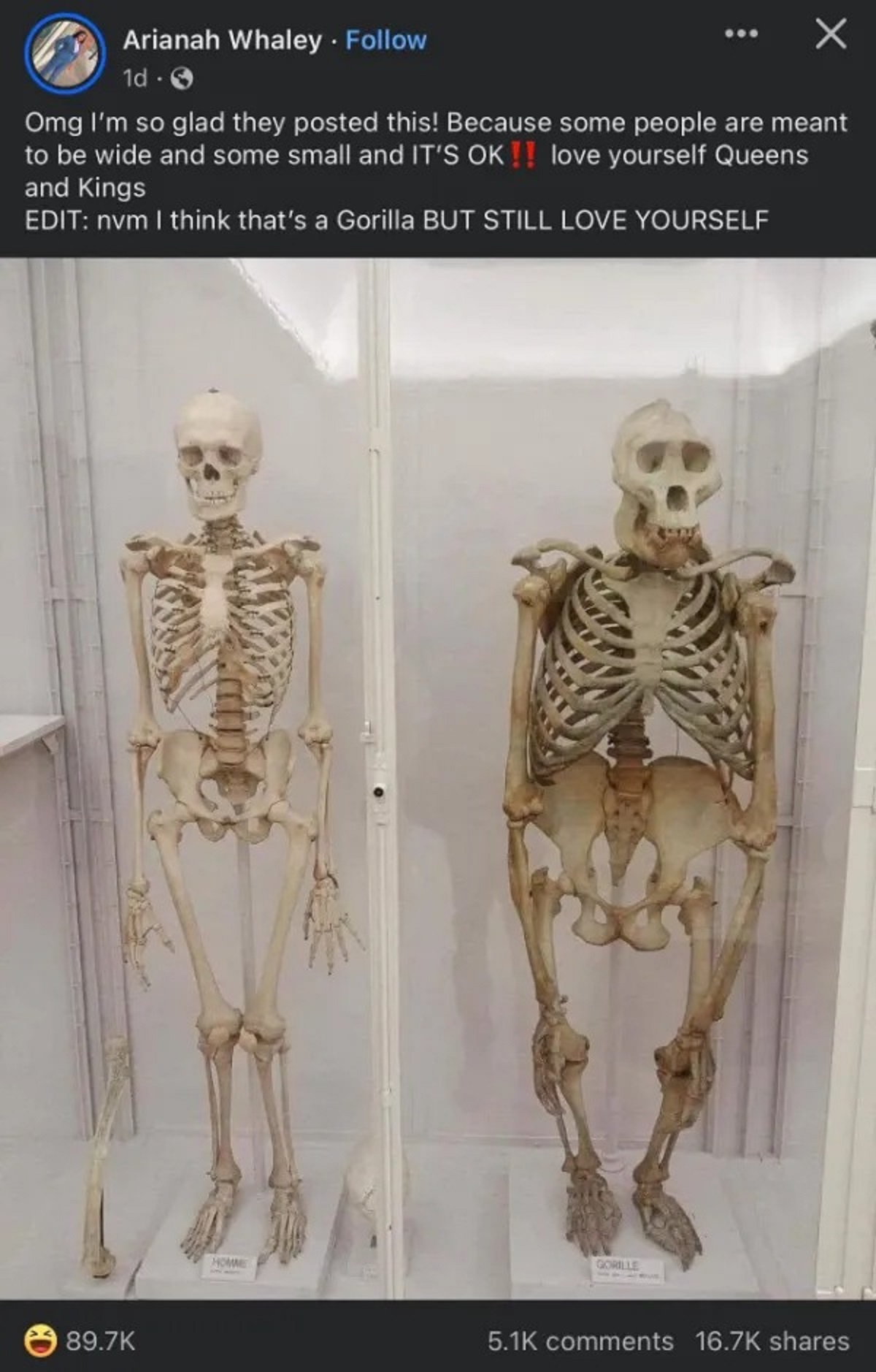 gorilla and human skeleton - Arianah Whaley. X 1d Omg I'm so glad they posted this! Because some people are meant to be wide and some small and It'S Ok !! love yourself Queens and Kings Edit nvm I think that's a Gorilla But Still Love Yourself Homme Goril