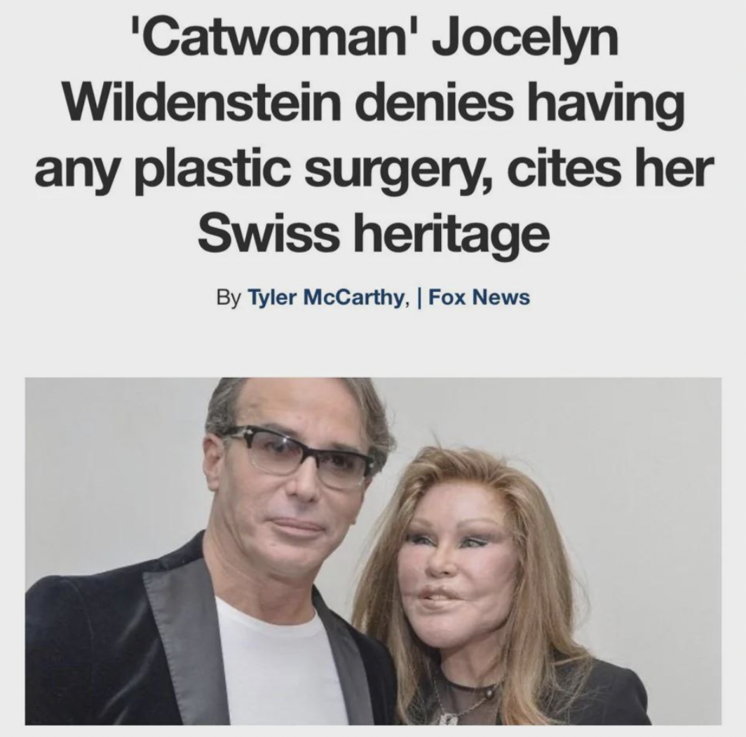 cat woman boyfriend - 'Catwoman' Jocelyn Wildenstein denies having any plastic surgery, cites her Swiss heritage By Tyler McCarthy, | Fox News