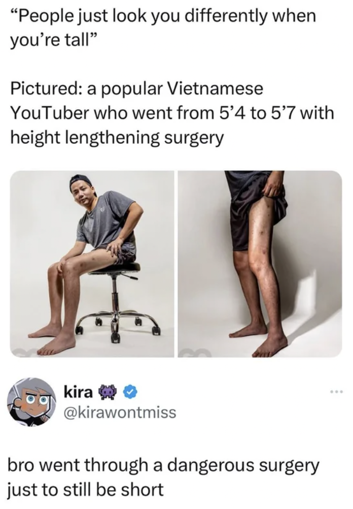 sitting - "People just look you differently when you're tall" Pictured a popular Vietnamese YouTuber who went from 5'4 to 5'7 with height lengthening surgery kira bro went through a dangerous surgery just to still be short