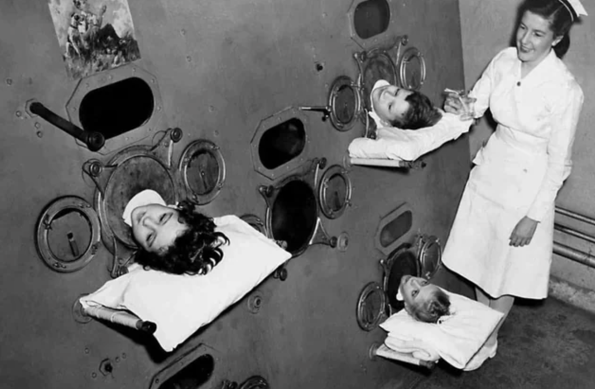 Children with polio in a US hospital, inside an iron lung.