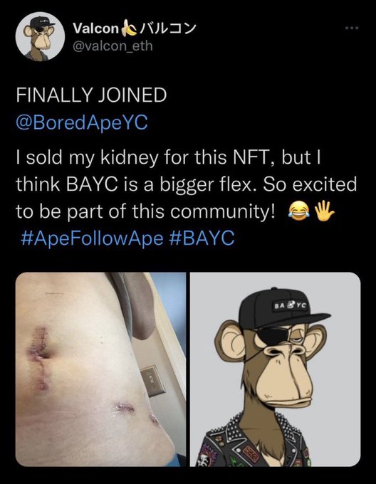 guy sells kidney for nft - Valcon Finally Joined ApeYC I sold my kidney for this Nft, but I think Bayc is a bigger flex. So excited to be part of this community!