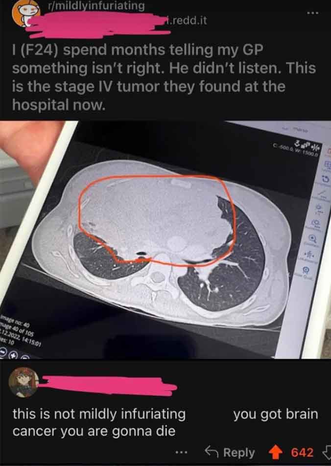 computed tomography - rmildlyinfuriating .redd.it 1 F24 spend months telling my Gp something isn't right. He didn't listen. This is the stage Iv tumor they found at the hospital now. Image no 40 mage 40 of 105 12.2022, 01 es 10 this is not mildly infuriat