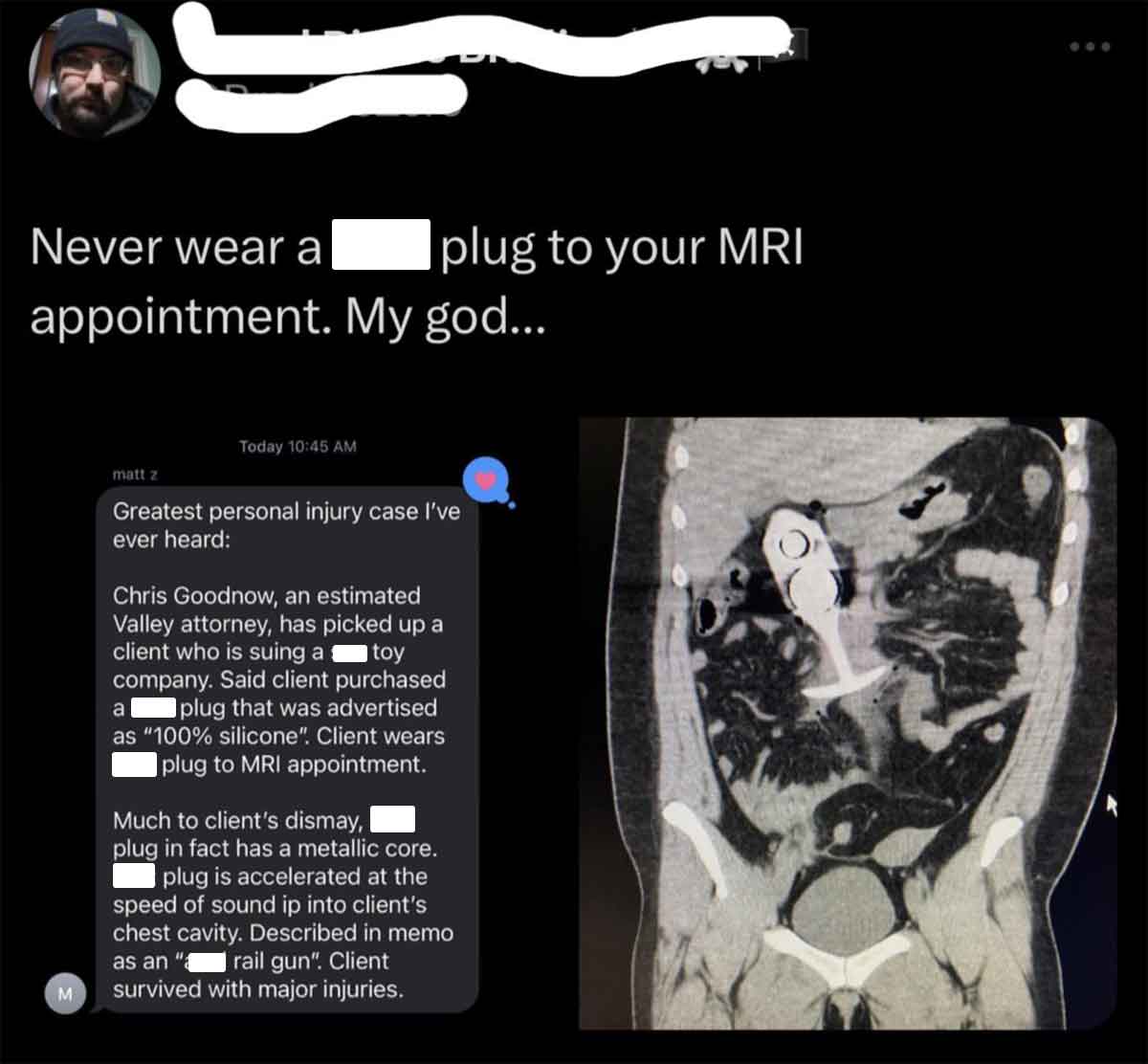 screenshot - Never wear a plug to your Mri appointment. My god... matt z Today M Greatest personal injury case I've ever heard Chris Goodnow, an estimated Valley attorney, has picked up a client who is suing a toy company. Said client purchased plug that