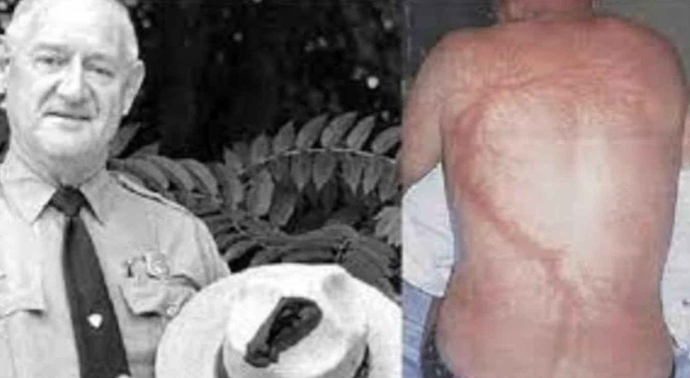 The “Human Lightning Rod” American park ranger Roy Cleveland Sullivan was been hit by lightning seven times and survived. 